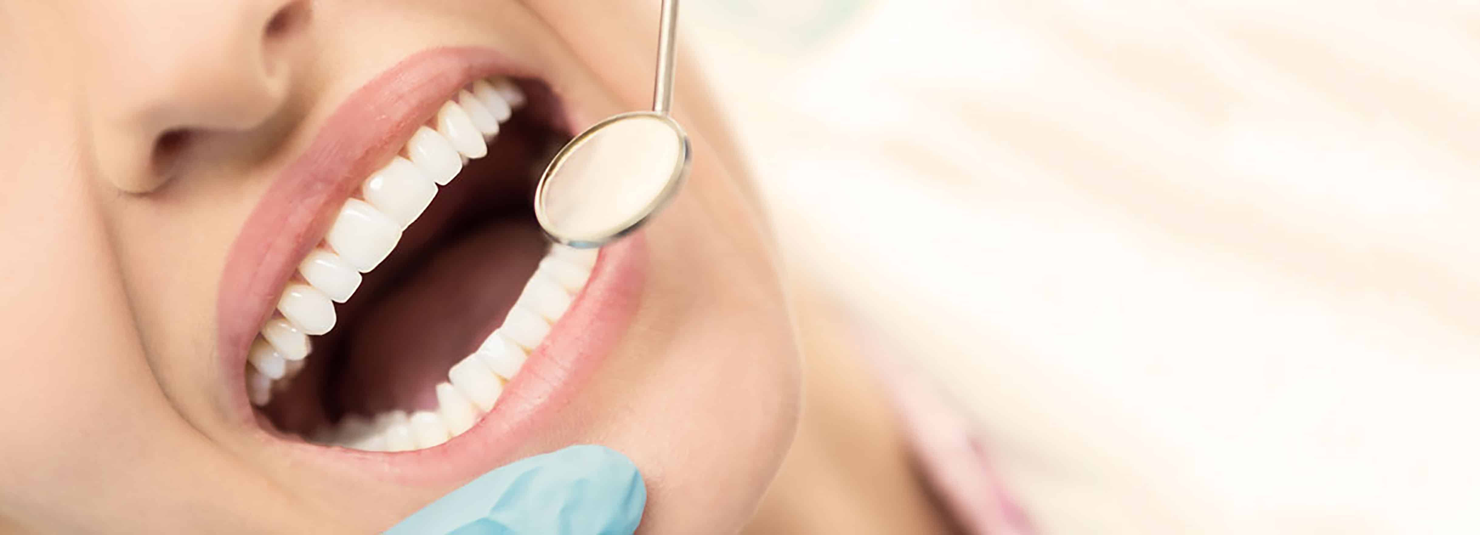 сколько стоит ультразвуковое отбеливание зубов