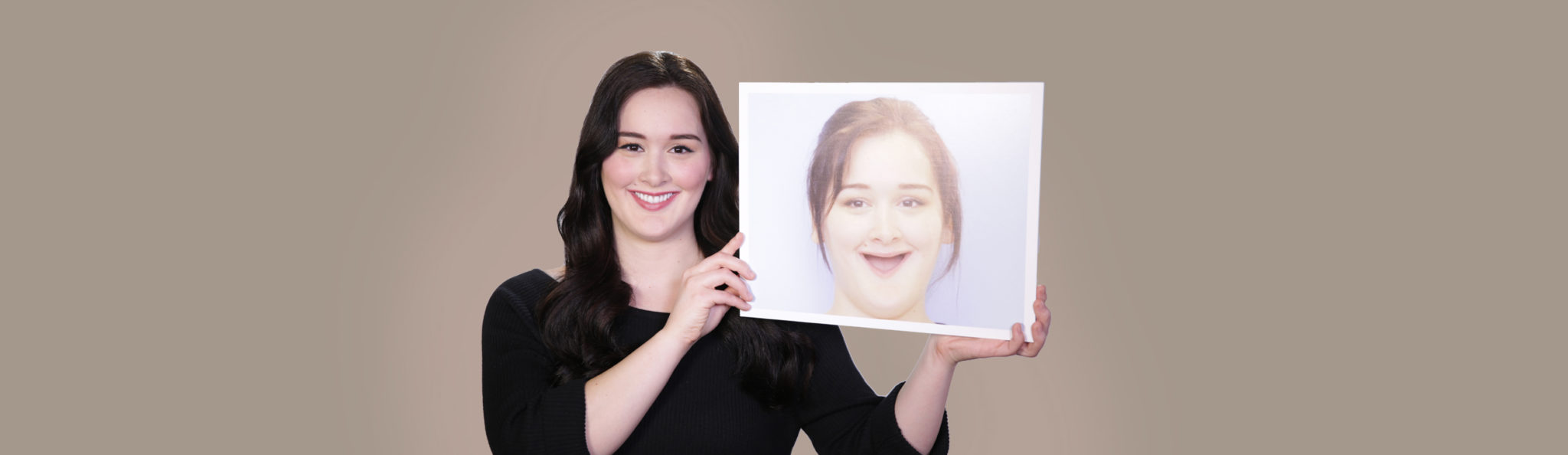 Bone Loss Patient With Zygomatic Dental Implants Surgery holds her before photo
