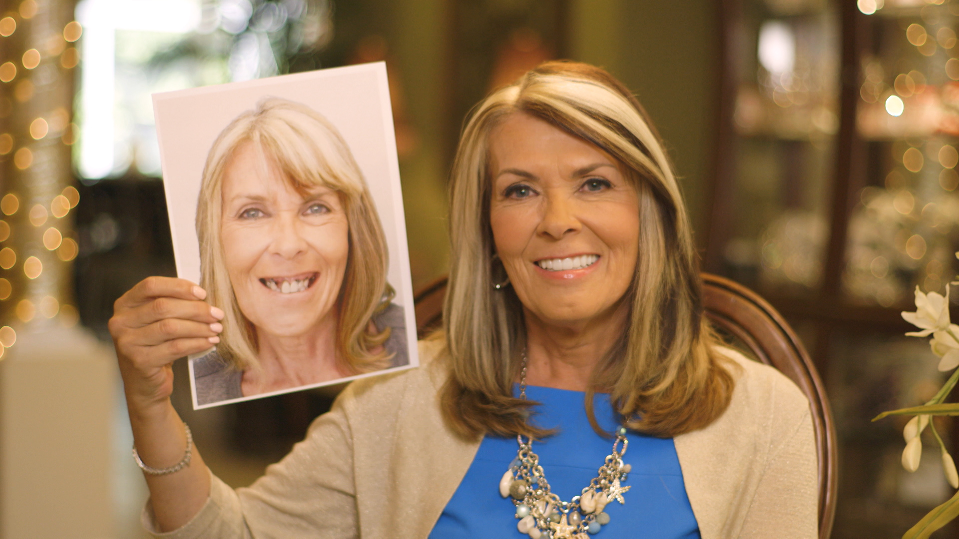 Dental Implants Patient Donna