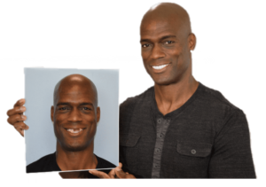 before and after patient tyrone isolated transparent background