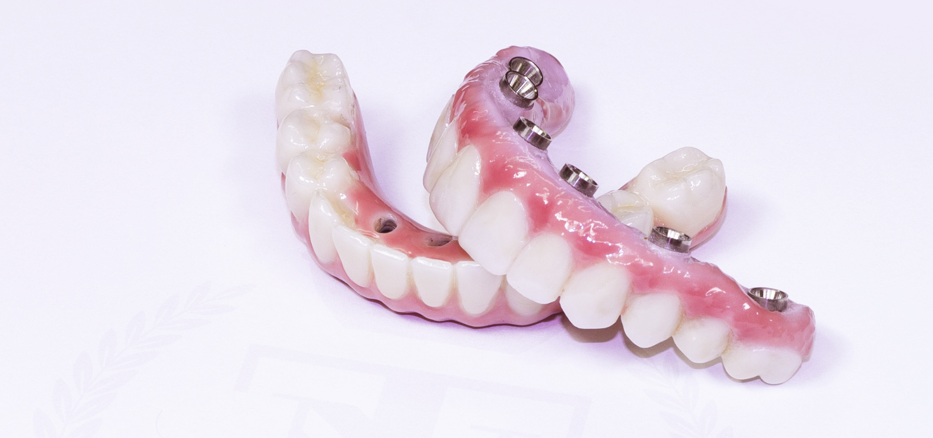 7 methods for Dental Implants