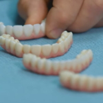 Common Questions about Zirconia Teeth