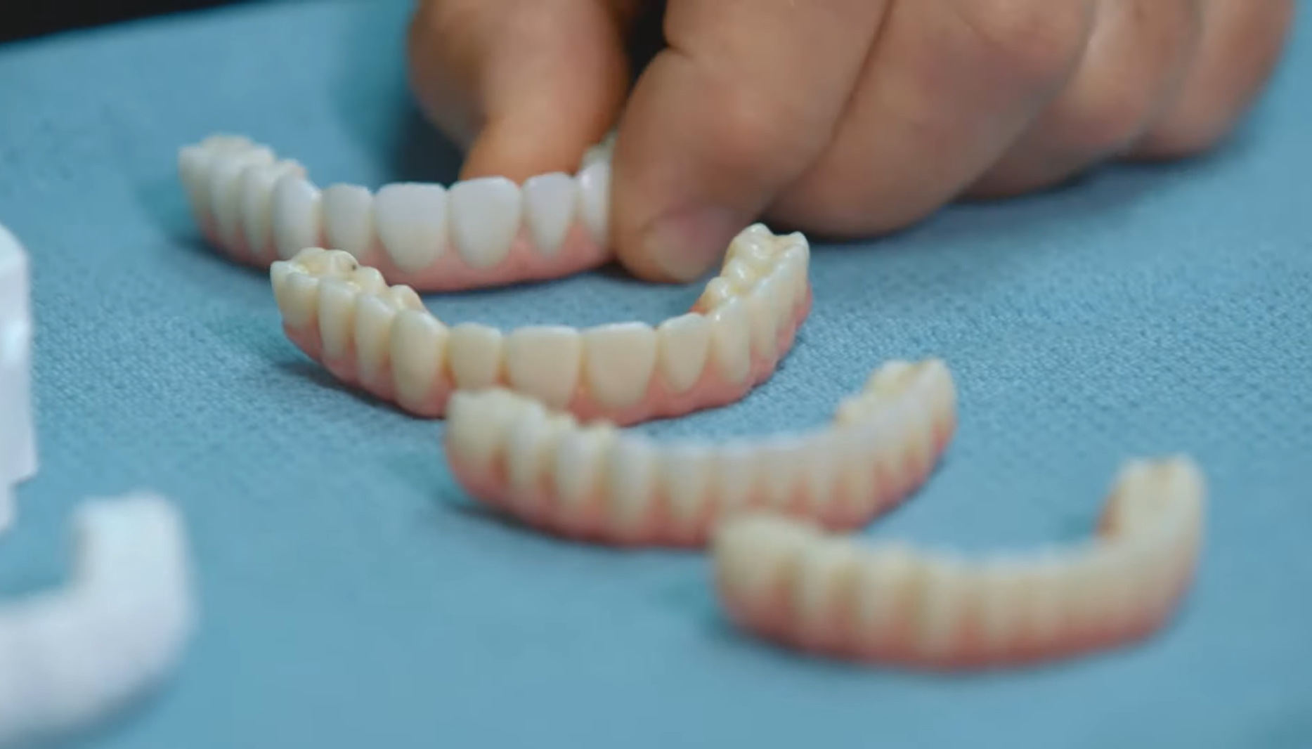 Common Questions about Zirconia Teeth