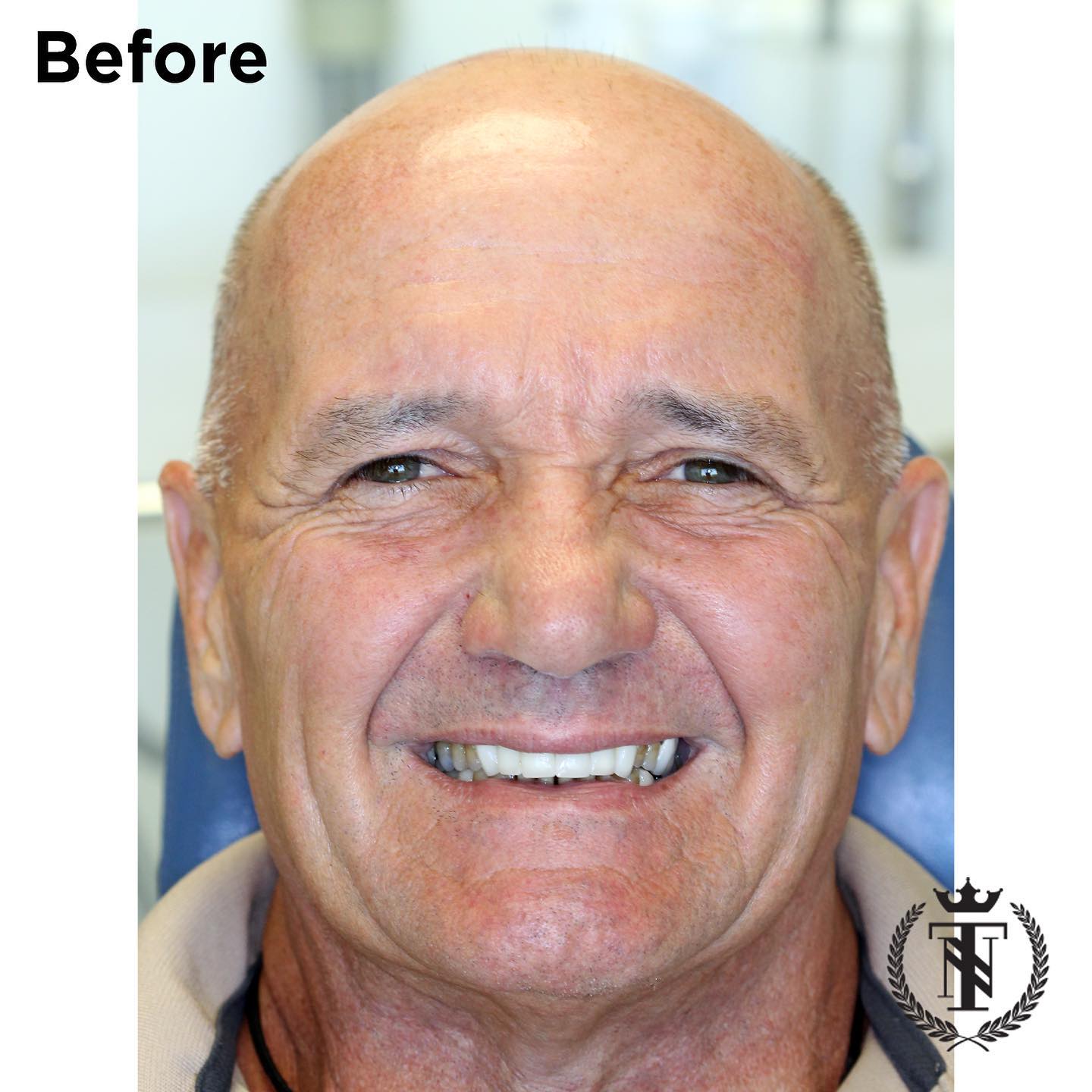 joe transformed smiles