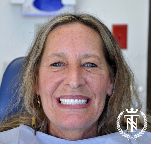 Terry-Ann transformed smiles