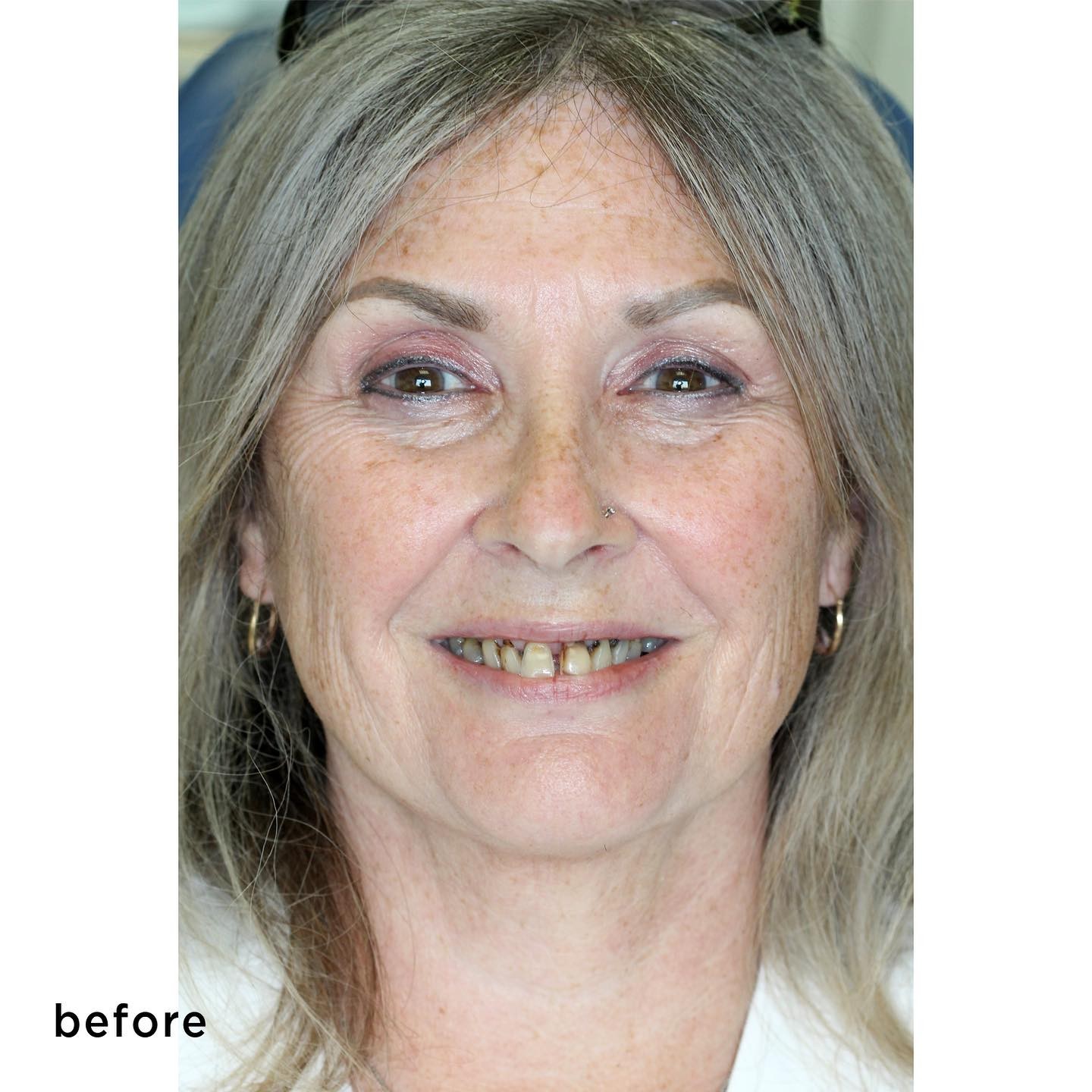 Kathy kowalsky Transformed Smiles