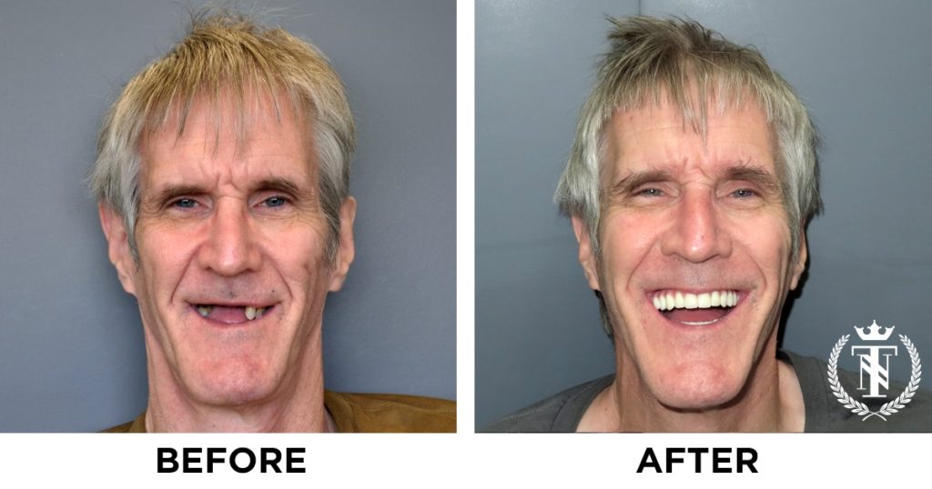 Steven Transformed Smiles