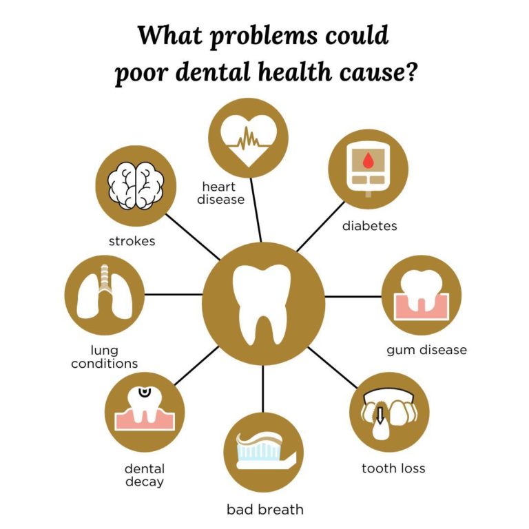 Cost of Zygomatic Dental Implants