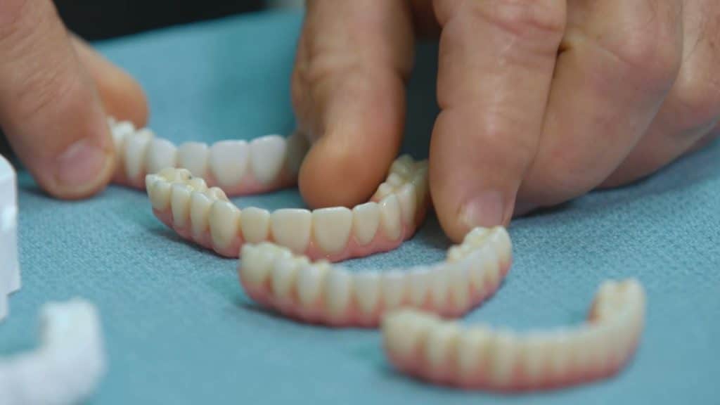Common Questions about Zirconia Teeth