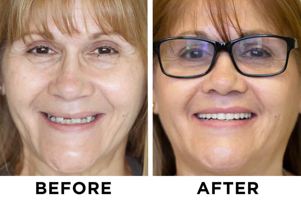 new teeth now patient 27