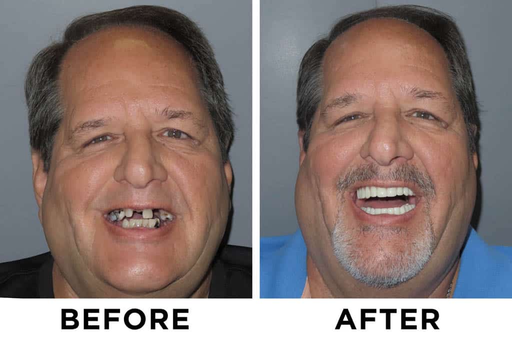 new teeth now patient 3