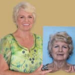 Dental Implants and Aging: Why It’s Never Too Late for a New Smile