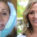 A New Smile, Step by Step: Inside the New Teeth Now Experience