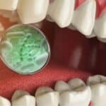 The Connection Between Gum Disease and Alzheimer’s Disease