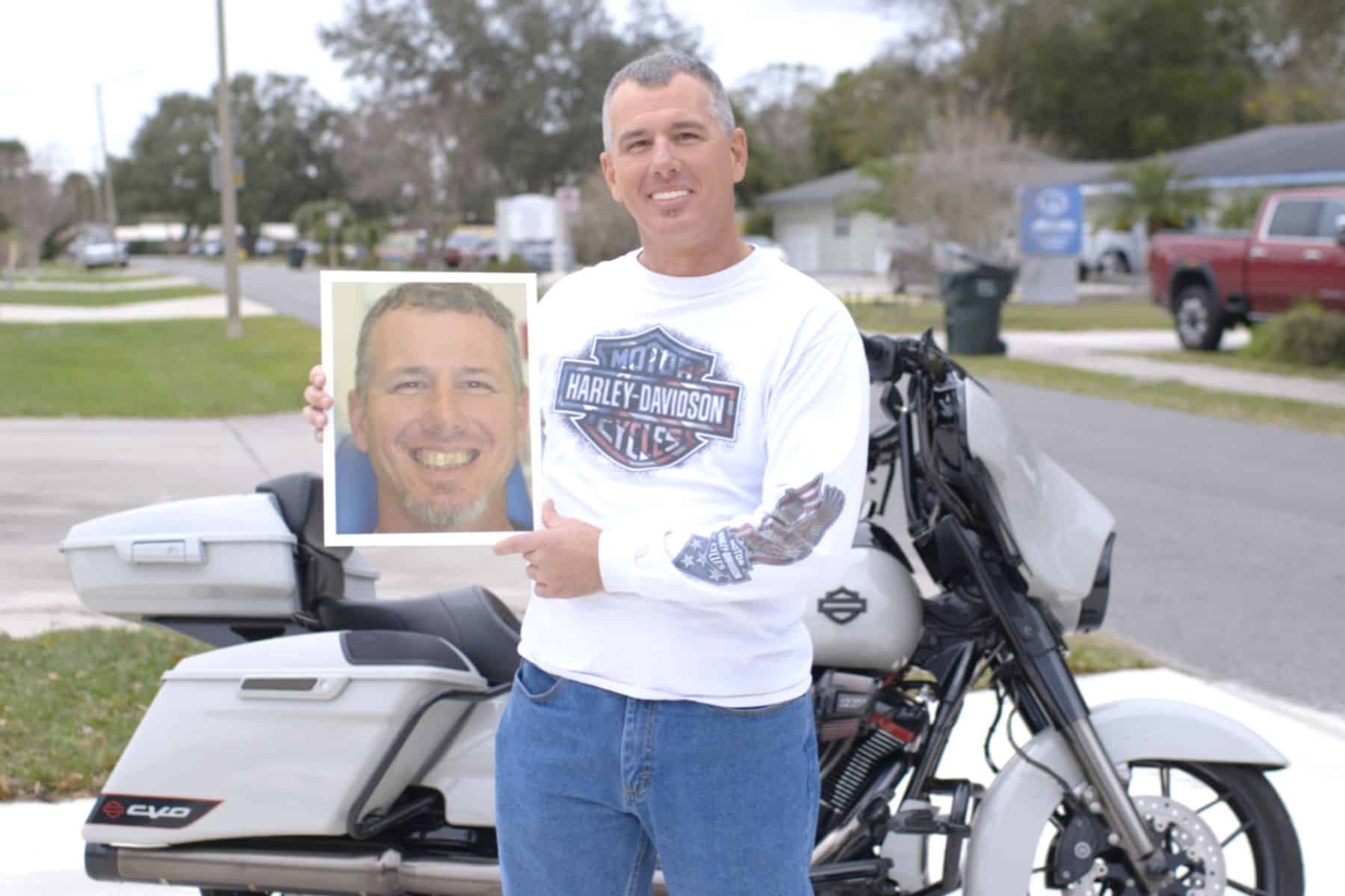 before after dental implants