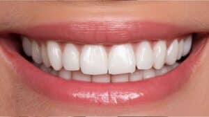 Close up of a woman's healthy smiling teeth.